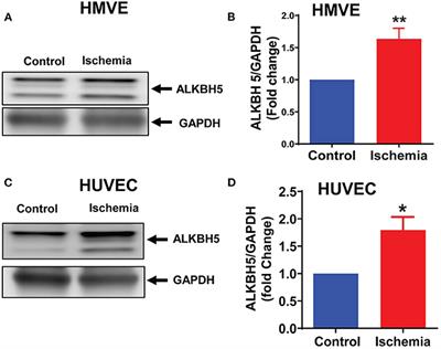 ALKBH5 Regulates SPHK1-Dependent Endothelial Cell Angiogenesis Following Ischemic Stress